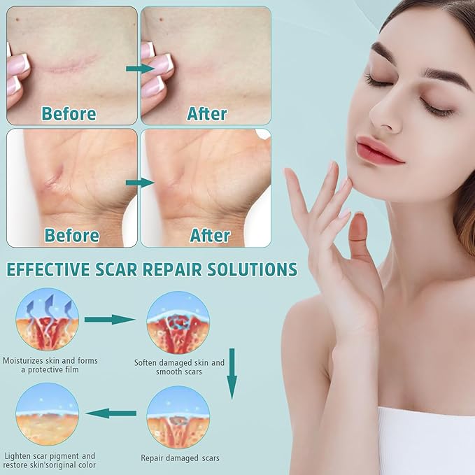 Advanced Scar Cream, Silicone Gel for Scars, Professional Scar Removal Cream for Surgical Scars, Stretch Marks, Old and New Scars 1.7 oz(50ml)-VivaGrace Women