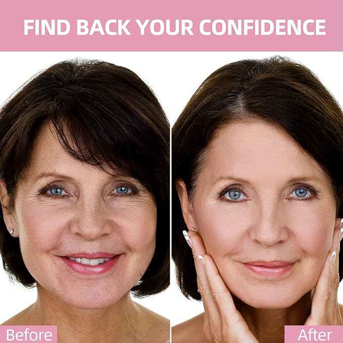 Face Wrinkle Patches – for Forehead Lines, Frown Areas, Smile Creases & Fine Signs – Overnight Anti-Aging Facial Stickers to Smooth Skin, Safe and Gentle for All Skin Types, 160 Pcs Included-VivaGrace Women