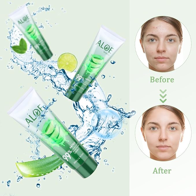 200x2 ML Aloe Vera Gel – 99% Organic Pure Aloe Vera Hydrating Face & Body Moisturizer, Natural Aloe Cream for Dry Skin, Sunburn, Acne, Soothing & Moisturizing-VivaGrace Women