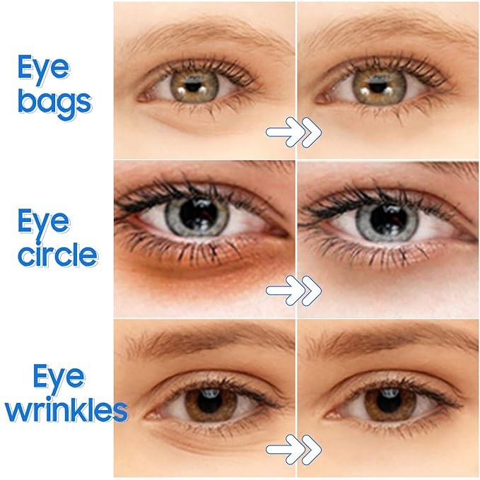 Under Eye Patches- 28 Pairs Blueberry Collagen Eye Mask Eye Patches for Reducing Puffy Eyes and Dark Circles, Anti Aging Gel Eye Pads Under Eye Mask, Blue-VivaGrace Women