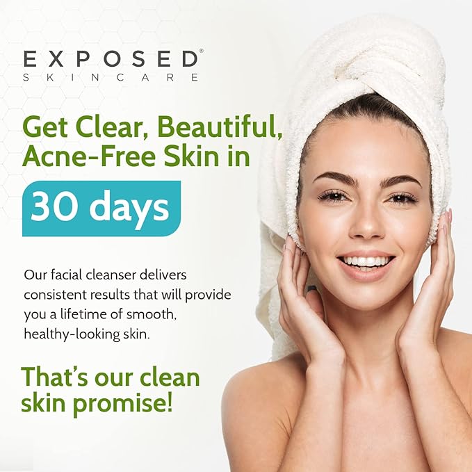 Exposed Skin Care Acne Facial Cleanser - Gentle Face Wash with Salicylic Acid for Acne Prone Skin - Pore Clarifying Acne Treatment for All Ages, Skin Types-VivaGrace Women