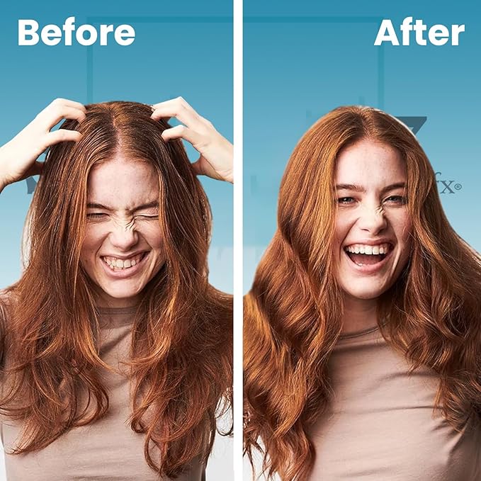 SUDZZFX Refresh Ultimate Dry Shampoo for Women - Waterless Shampoo - for Most Hair Types - Absorbs Excess Oil - Adds Light Volume & Texture - Color Protection-VivaGrace Women