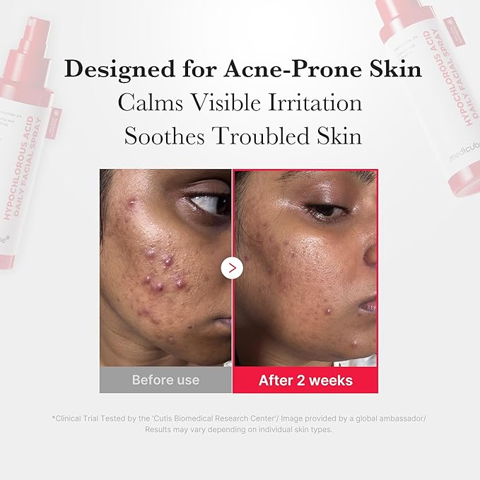 medicube Power Soothing Spray | Hypochlorous Acid Spray For All Skin Types, Delicate Skin | Daily Skin Solution & Post-Sun Care | HOCI Facial Mist for Soothing & Calming | Korean Skincare | 4.22 fl.oz-VivaGrace Women