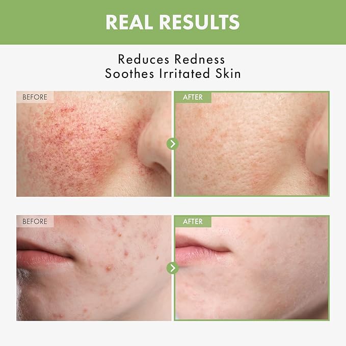 Heartleaf Face Toner with 970,200ppm Heartleaf Water, Centella, Hyaluronic Acid, Witch Hazel, Trouble Care, Acne-Prone, Calming, Hydrating, Purifying, Korean Skin Care, 250ml, 8.45 fl.oz.-VivaGrace Women