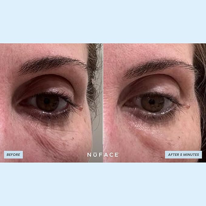 NuFACE IonPlex Hydra-Gel Power Under Eye Patches - Gel Under Eye Mask for Puffy Eyes & Dark Circles - Cooling Wrinkle Patches & Hydrating Treatment Pads to Energize, Brighten & Tighten (60 Count)-VivaGrace Women