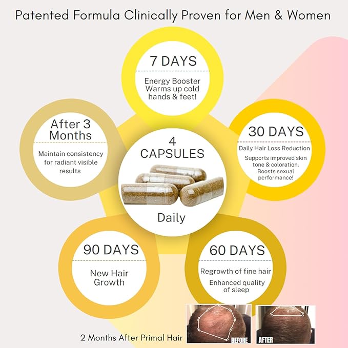 3 PK- 100% Natural Growth Treatment, Reduces Hair Loss, US Patented Formula Proven Effective for Men & Women, 100% Vegan, Non-GMO, 90-Day Supply, 3 Pack-VivaGrace Women