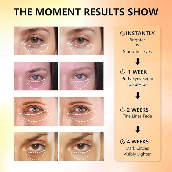 Under Eye Patches with Vitamin C & Caffeine 30 Pairs for Dark Circles, Fine Lines and Puffiness, with Niacinamide Hydra-Gel Collagen, Skin Care for Men & Women-VivaGrace Women