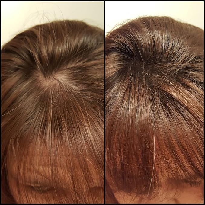 Thinning Hair Solution - All-Natural, Plant-Based Fibers For Fuller, Thicker Appearance. Instantly Covers Bald Spots. Auburn (red/ginger hair). Trial Size, 10-Day Supply-VivaGrace Women