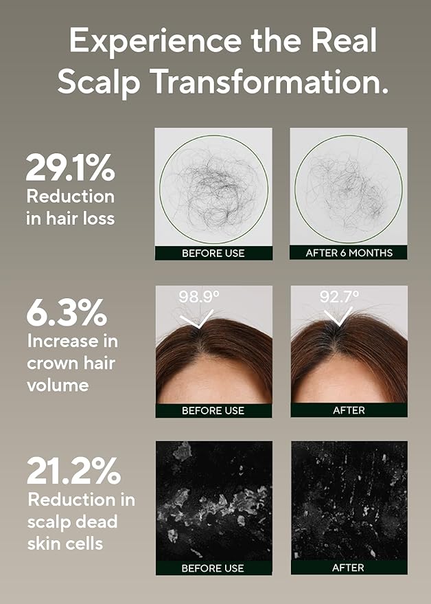AROMATICA Rosemary Salt Scrub Shampoo - Hair Loss Korean Scalp Detox Shampoo with Rosemary Scalp Oil | Scalp Exfoliator with Salt Scrub for Oily Scalp | Sulfate Free, Silicone Free (10.5 oz / 300g)-VivaGrace Women