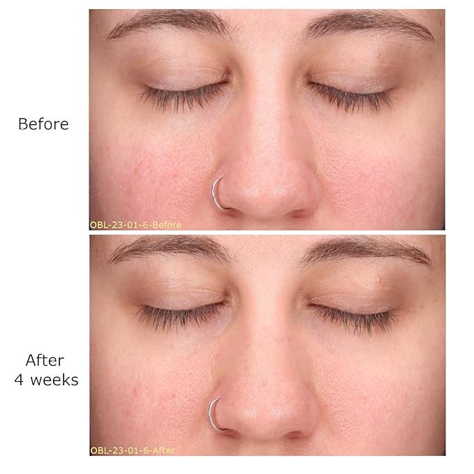 Daily Moisturizing Collection, Activator with Clarifying Azelaic Acid+ Concentrate Starter, Brightening, Firming Clarity, Suitable for Sensitive Skin, Gift Bundle/Starter Kit-VivaGrace Women