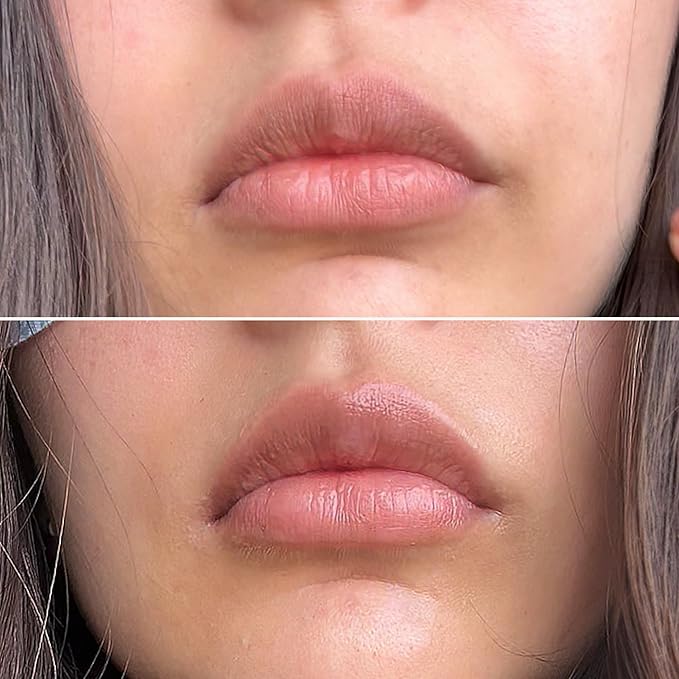 Talika Smile Patch | New Hydrating Lip Mask | Helps To Moisturize, Replenish And Nourish The Lips-VivaGrace Women