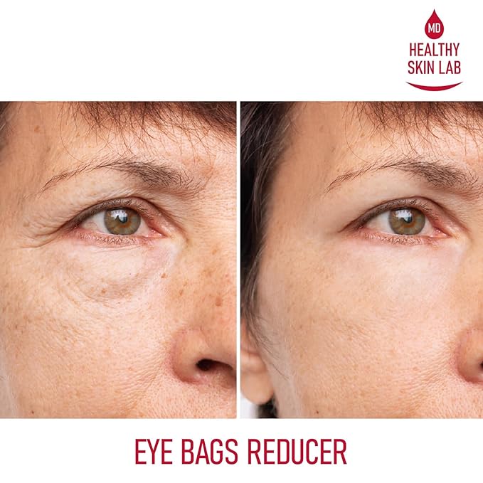 Reusable Under Eye Patches, Reduce Dark Circles, Puffy Eyes, Undereye Bags & Wrinkles - Medical-Grade Silicon Patches Reusable For Up To 3 Weeks-VivaGrace Women