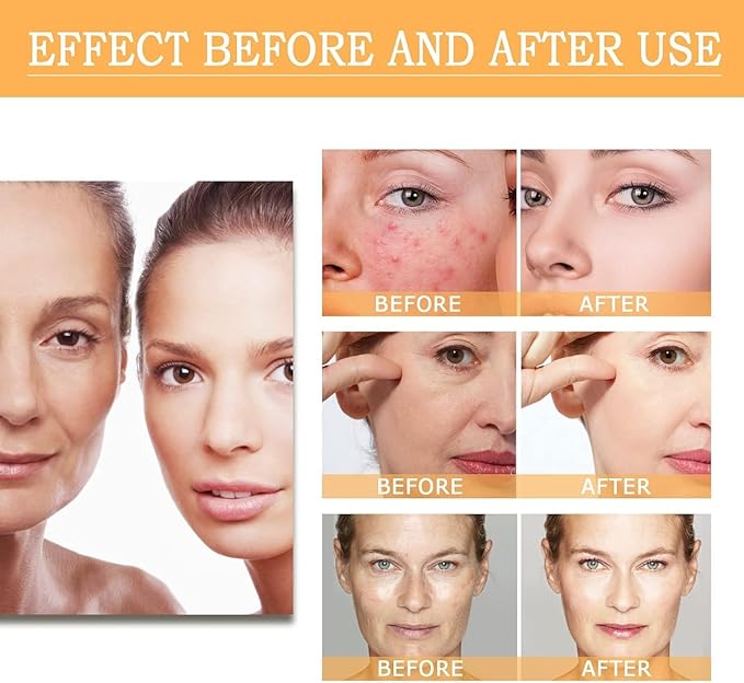 Glycolic Acid Toning Solution, Glycolic Acid 7% Toner, Glycolic Sour 7% Toning, KeepThe Skin Moist, Exfoliating Serum for Face, Facial Exfoliation Astringe Pores (240ML/8.0 Fl Oz)-VivaGrace Women