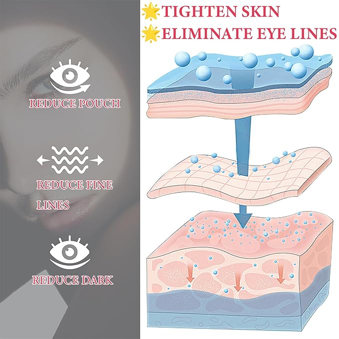 Retinol Eye Cream for Dark Circles and Puffiness,Under Eye Cream with Collagen & Hyaluronic Acid,Fix Wrinkle,Lightweight Lift Eye Cream,Brighten Tighten Eye Cream Gel to Smooth Fine Lines & Hydrate-VivaGrace Women