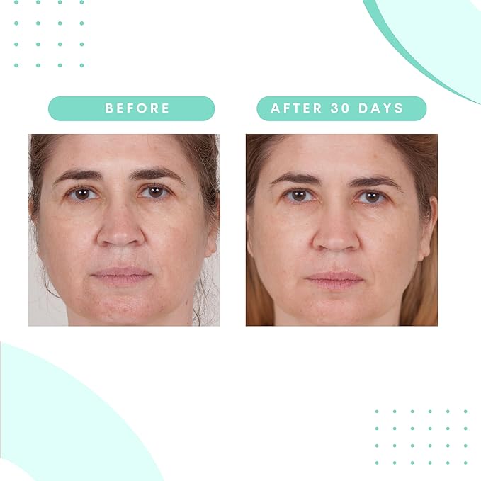 Serious Skincare Glycolic Skin Renewal Set - Retexturizing Serum - Facial Moisture Cream - Face Wash Cleanser - Balancing Blue Tansy Extract - Improve Appearance of Lines, Wrinkles and Enlarged Pores-VivaGrace Women