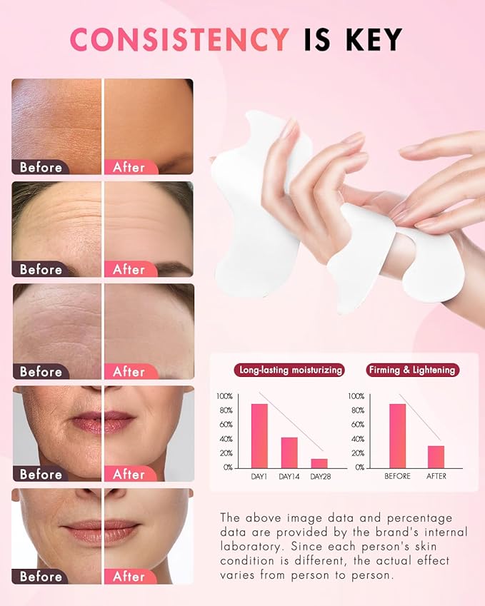 Forehead Wrinkle Patches & Smile Line Patches, Overnight Facial Wrinkle Treatment with Hyaluronic Acid, Aloe, Collagen & Vitamin E to Lift Smile Lines for Women 72pcs-VivaGrace Women