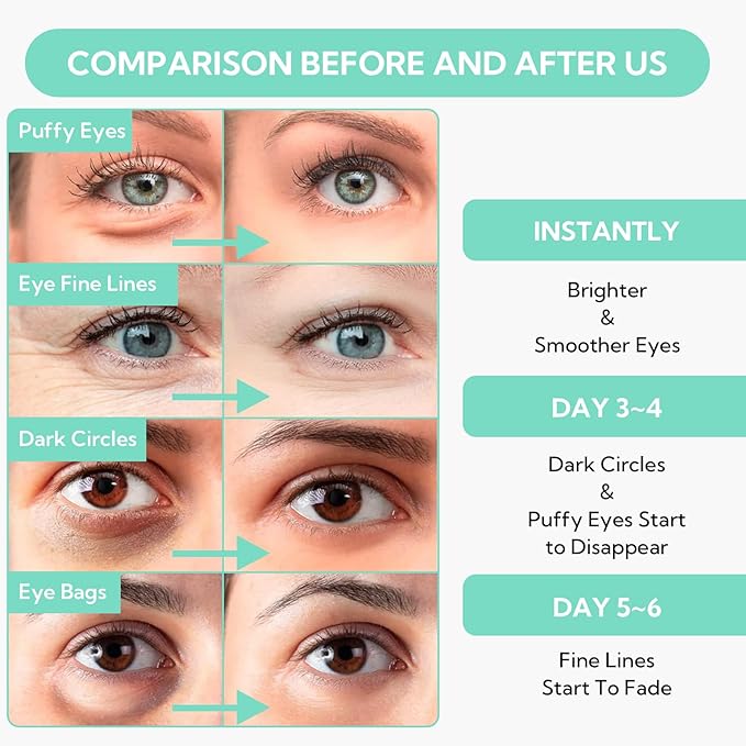 8X Hyaluronic Acid Under Eye Patches(30 Pairs) -Cooling Eye Masks for Deep Moisturizing, with Ectoin Niacinamide Hydra-Gel Collagen, Puffy Eyes Treatment, Fine Lines & Wrinkles Reduce-VivaGrace Women