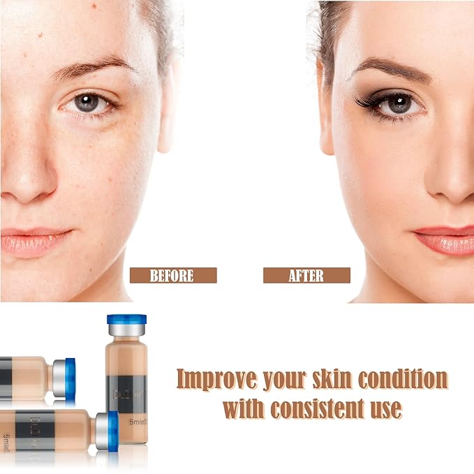 BB Facial Glow Starter Kit Facial Pigment Serum Treatment Kit,Anti-Aging Serum Pigments Set for Micro-needling Skin Treatment 10 Vials 5ml Hyaluronic Acid Ampoule foundation Essence Skin-VivaGrace Women