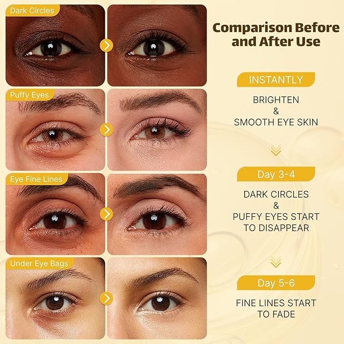 Under Eye Patches for Puffy Eyes and Dark Circles (20 Pairs), Under Eye Gold Mask with Hyaluronic Acid & Collagen to Reduce Wrinkles and Relieve Pressure, Eye Care Treatment for Men & Women Gift-VivaGrace Women