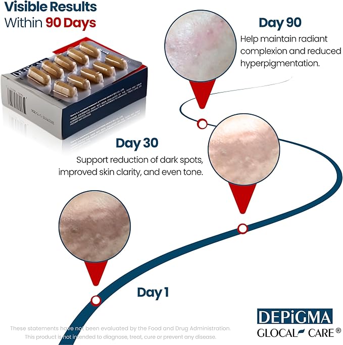 GlocalCare Depigma Support Reduction of Hyperpigmentation, Melasma & Dark Spots with Glutathione, Polypodium Leucotomos, Grape Seed & Marigold Extract-VivaGrace Women