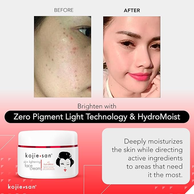 Kojie San Face & Body Complete Brightening Mini Set - 65 Gram x 2 Bars Soap, Body Lotion, Face Cream, and Facial Cleansing Brush-VivaGrace Women