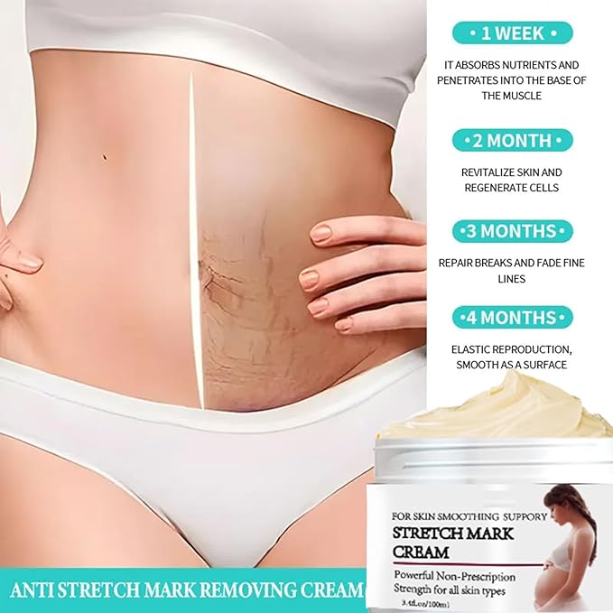 Stretch Mark Prevention Cream for Pregnancy, Stretch Mark Cream Remover, Stretch Mark Lotion for Pregnancy, Tummy Butter for Stretch Marks Pregnancy, Shea Butter Stretch Mark Removal Cream-VivaGrace Women