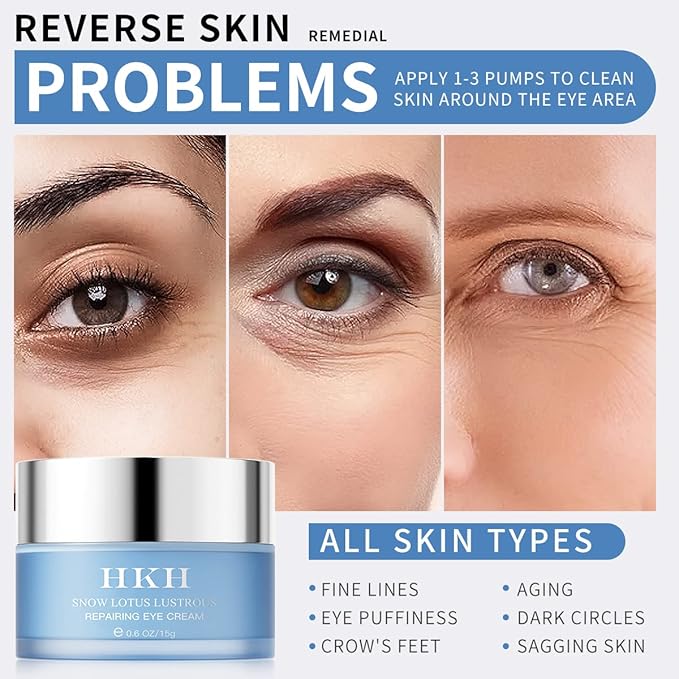 Dark Circles Under Eye Treatment for Women - Eye Cream for Dark Circles Wrinkles Puffiness & Fades Eye Wrinkles – Brighten the Eye Area Anti-Aging Collagen Eye Cream – Retinol Peptide-VivaGrace Women