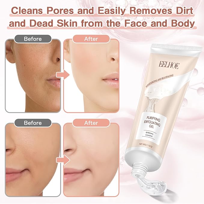 Purifying Exfoliating Gel, Exfoliating Scrub, Deep Cleansing Face, Hydrating and Moisturizing, Face and Body Care Purifying Exfoliating Moisturizing Gel(50g/1.76OZ)