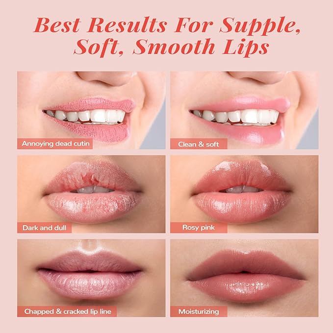 Lip Mask Set, Lip Scrub & Lip Butter, Overnight Lip Treatment Set Enriched With Skin Softening Ceramide & Watermelon and Hydrating Shea Butter, For A Softer & Smoother Pout-VivaGrace Women