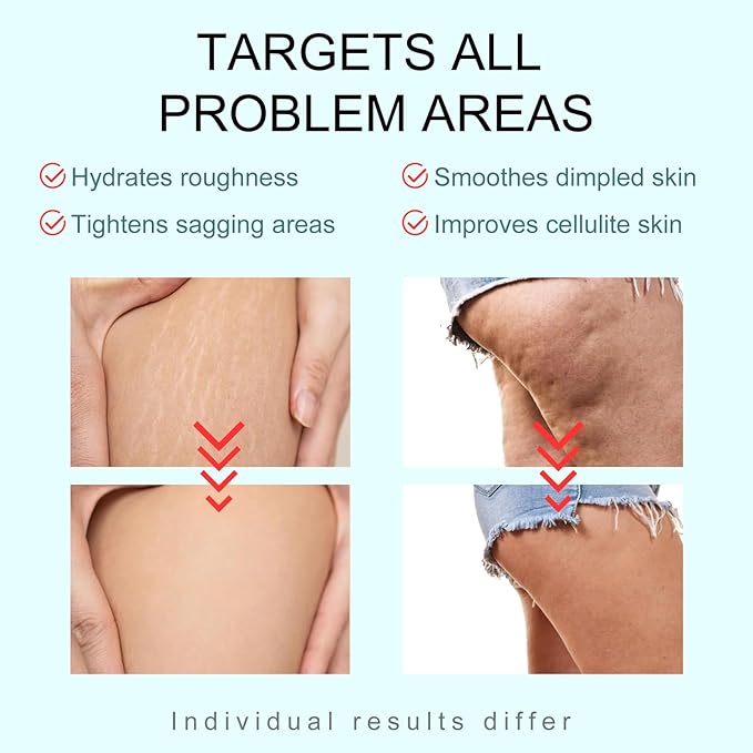 B-TIGHT Body Cream, 200ml Leave-On Booty Enhancing Mask, Firming & Moisturizing Cream, Leave-On Cellulite Mask - Improves Skin Tightness in Buttock Area, Lift sagging skin - 6.76 oz-VivaGrace Women