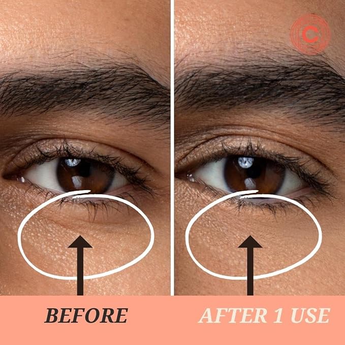 Depuffing Dissolvable Under Eye Masks - Enriched with Glucomannan, and Pumpkin Seed - Combat Fatigue, Reduce Puffiness, and Hydrate for a Fresh Look - Under Eye Mask Patches-VivaGrace Women