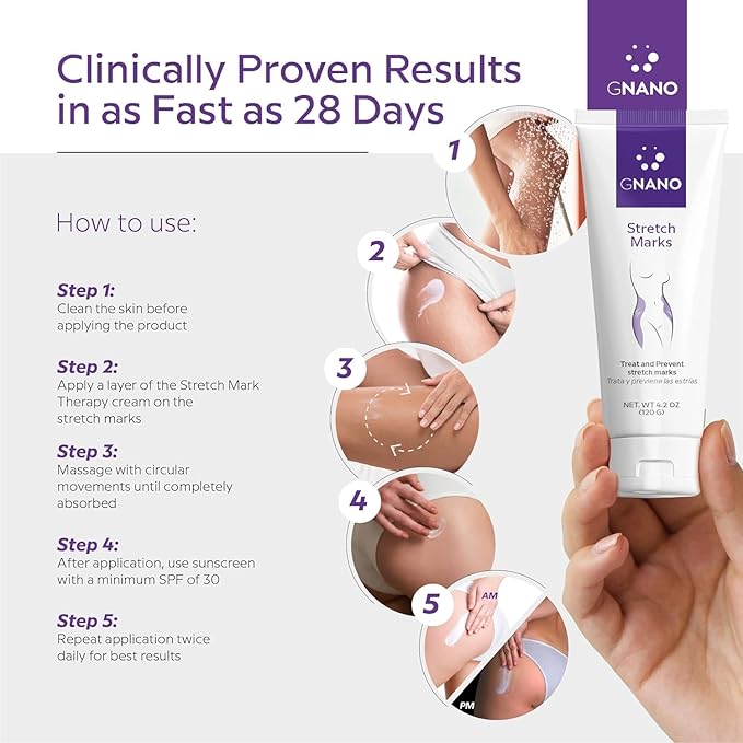 Advanced Stretch Mark Therapy Cream for Stretch Marks and firmer skin with Natural Ingredients to Prevent and get rid of Stretch Marks, Restores and Heals the Skin for Men and Women 4.2oz-VivaGrace Women