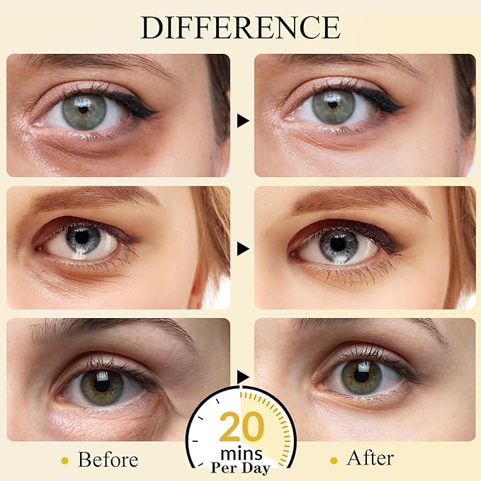 Under Eye Patches(30 Pairs), 24K Gold Eye Mask for Dark Circles, Puffy Eyes and Wrinkles, with Hyaluronic Acid & Collagen-VivaGrace Women