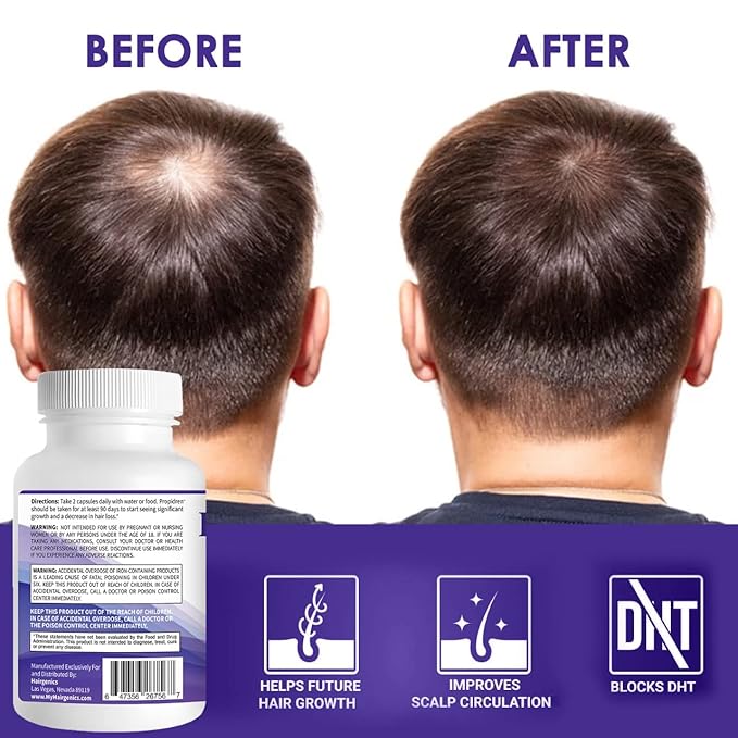 Propidren by HairGenics - DHT Blocker & Hair Growth Capsules to Prevent Hair Loss & Stimulate Hair Follicles, to Stop Hair Loss & Regrow Hair. Proprietary Anti-Hair Loss & Hair Regrowth Treatment.-VivaGrace Women