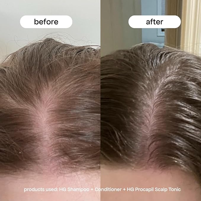 BONDIBOOST Procapil Scalp Treatment [4.23 fl oz], Daily Leave In Treatment for Thinning Hair + Anchor Hair, Scalp Serum for Thicker Hair with Procapil, Rosemary & Biotinoyl Tripeptide-1, Sulfate-Free-VivaGrace Women