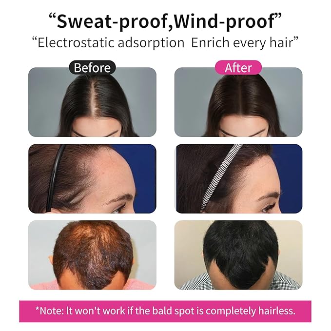 SEVICH Hair Fibers Refill 100g - Compatible with Most Brand Bottles | Hair Building Fibers for Thinning Hair | Instant Thickening Powder for Men & Women | 5-Second Natural Coverage,Medium Brown-VivaGrace Women