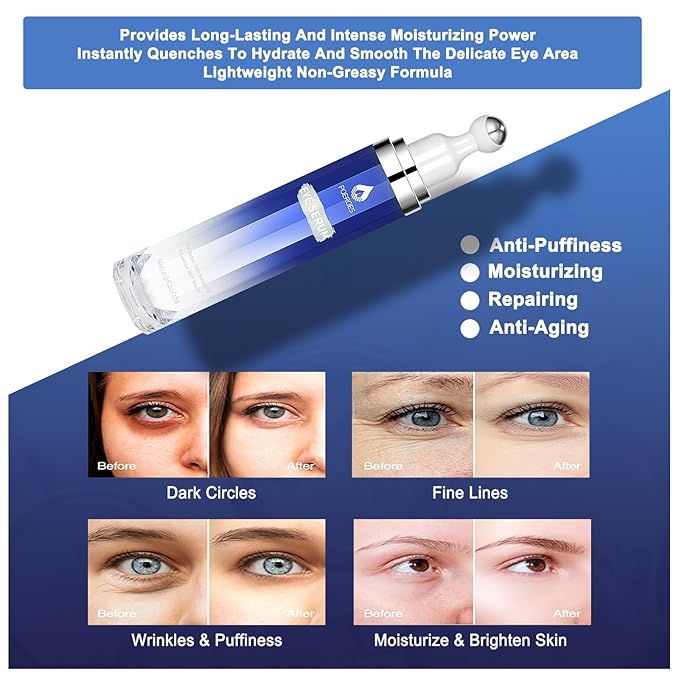 Under Eye Cream with 8% Caffeine & Retinol | Hyaluronic Acid, Niacinamide & Peptides | Eye Roller for Puffy Eyes, Dark Circles & Wrinkles | 2 fl. oz.…-VivaGrace Women