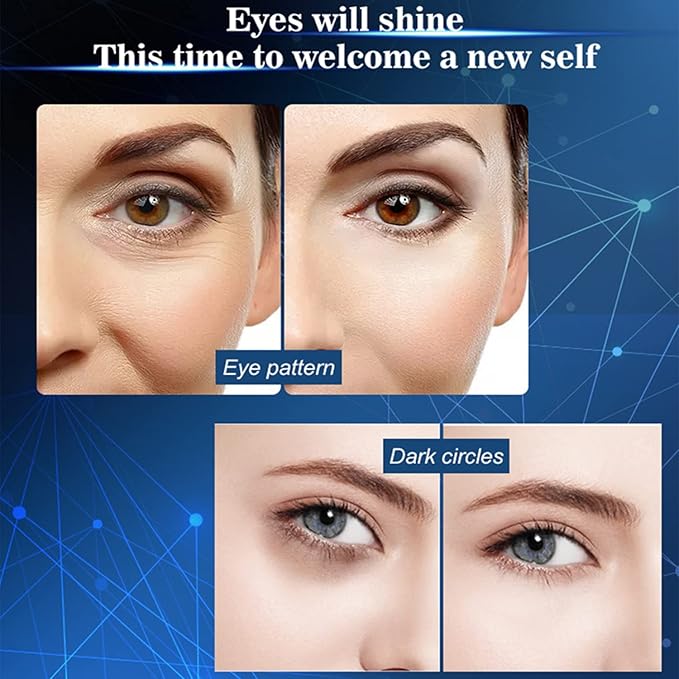 Argan Oil Eye Essence Hyaluronic Acid Anti-Wrinkle Anti-Aging Remove Eyes Pouch 25ml/0.88fl.oz-VivaGrace Women