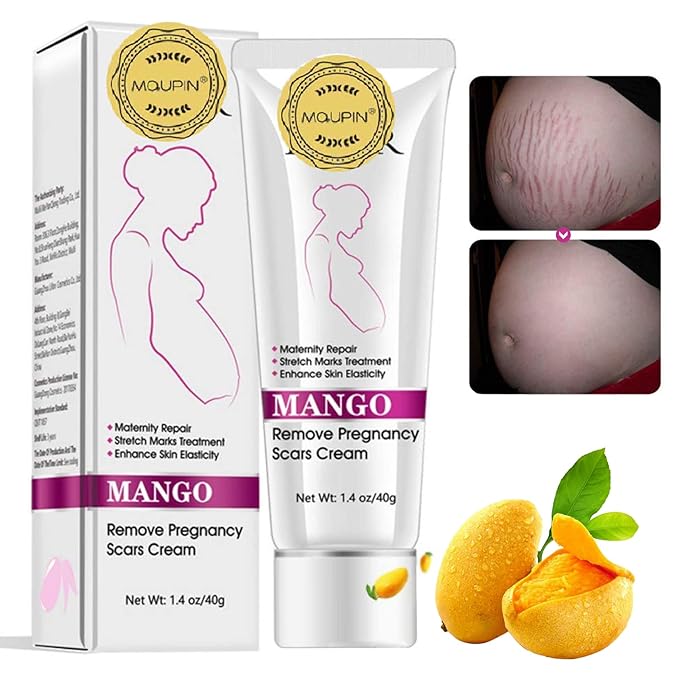 RtopR Mango Stretch Marks and Scar Cream -Stretch Marks and Scar Removal Cream for Pregnancy - Best Body Moisturizer-40g-VivaGrace Women