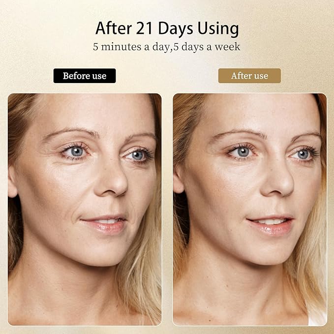 8 Modes&3 Color Facial-Massager-Device(Gold)-VivaGrace Women