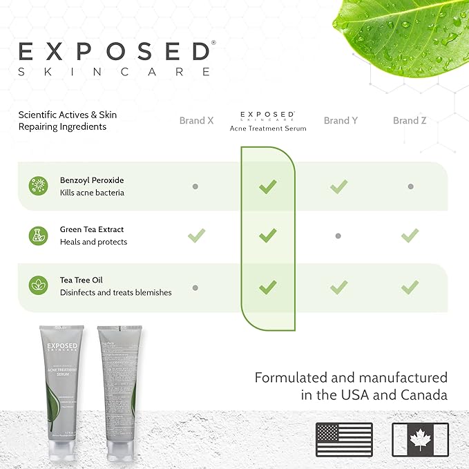 Exposed Skin Care Acne Treatment Serum Step 3 – Quickly Reduces Pimple Size and Redness - 12 Hour Spot Treatment - 3.5% Benzoyl Peroxide, Natural Green Tea & Tea Tree Oil-VivaGrace Women