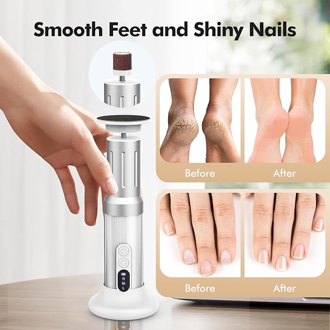 Electric Foot Callus Remover Cordless Electric Foot Filer Kit with 6Speeds Chagring Dock Callus Remover for Women Men Feet and Nail (White)-VivaGrace Women
