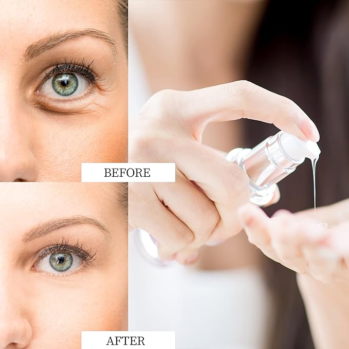 Eye Cream for Dark Circles and Puffiness - Rapid Reduction Under Eye Care Collagen Treatment Serum 1.7 oz-VivaGrace Women