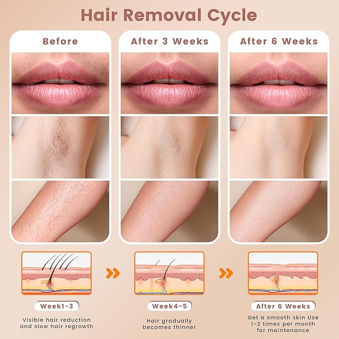 Hair Removal Device, Hair Removal for Women and Men，Hair Removal Body and Face for Home Use,model S3