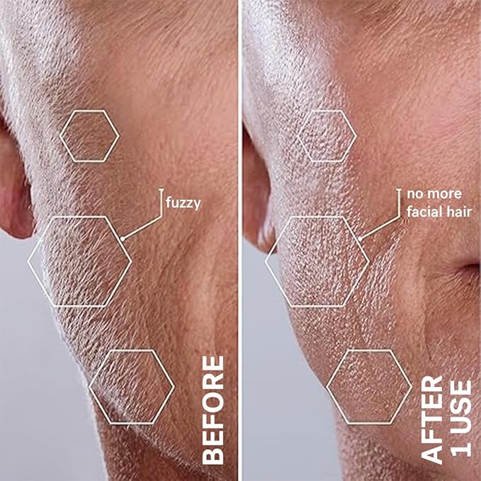 Michael Todd Beauty Sonicsmooth Dermaplane Razor for Women Face + Eyebrow trimmer Dermaplaning System - Peach Fuzz Remover - 8 Weeks of Dermaplaning Blades-VivaGrace Women