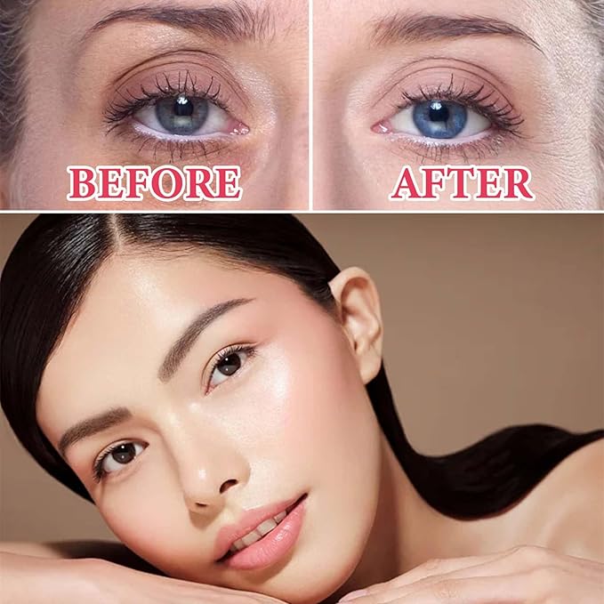 Retinol Eye Cream for Dark Circles and Puffiness,Under Eye Cream with Collagen & Hyaluronic Acid,Fix Wrinkle,Lightweight Lift Eye Cream,Brighten Tighten Eye Cream Gel to Smooth Fine Lines & Hydrate-VivaGrace Women