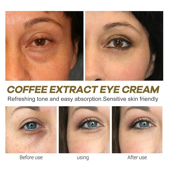 2PCS Caffeine Eye Cream for Dark Circles and Puffiness, Anti-Wrinkle Stay-Up Late Retinol Eye Cream, Tightening & Firming Skin, Dilute Dark Circles-VivaGrace Women