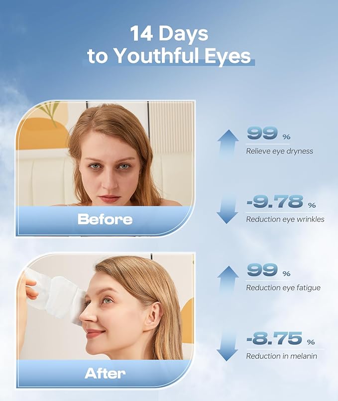 Hyaluronic Acid Self Heating Warm Compress for Eyes, Heated Eye Mask for Fast Relief of Dry Eyes, 14 Pack Steam Eye Mask, Moisturizing & Highly Effective Steam Eye Mask-VivaGrace Women