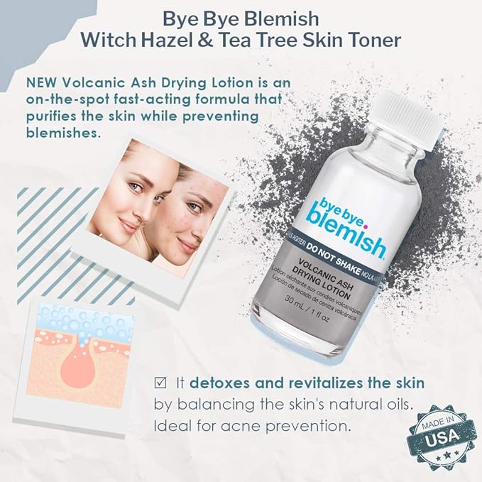 Bye Bye Blemish Drying Lotion Volcanic Ash | Acne Drying Solution To Assist With Blemish Prevention | 1 Fl. Oz.-VivaGrace Women