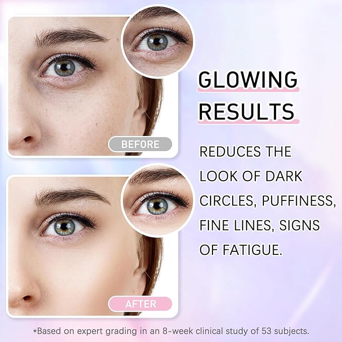 5% Caffeine Eye Cream Eye Serum Kit for Dark Circles Under Eye Treatment For Puffiness Bags And Wrinkles Eye Cream Anti Aging Eye Serum & Eye Roller 2 Fl Oz-VivaGrace Women